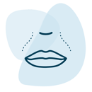 Filler - nasolabial folds
