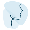 filler - jawline